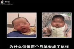 揭婴儿变大头娃原因