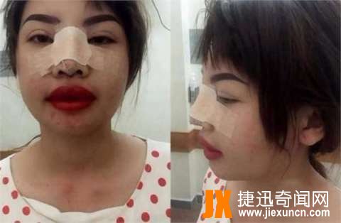 越南95后少女嫌自己丑，花3亿整成“女神”！
