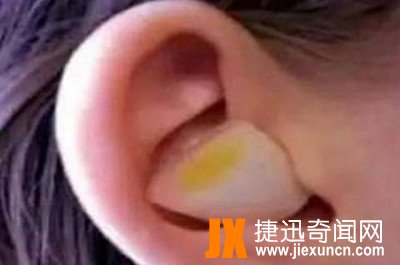 洋葱的奇迹