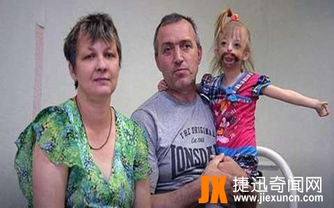 俄小女孩出世就没嘴巴,医生劝父母安乐死,父母不能接受