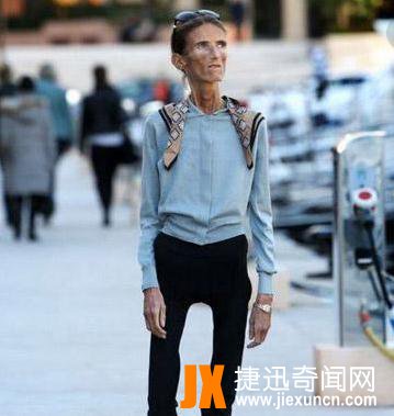 世界上最瘦的人