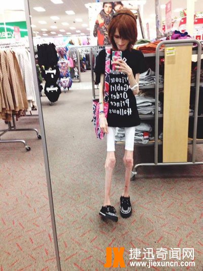 世界上最瘦的人,美国少女Ashley