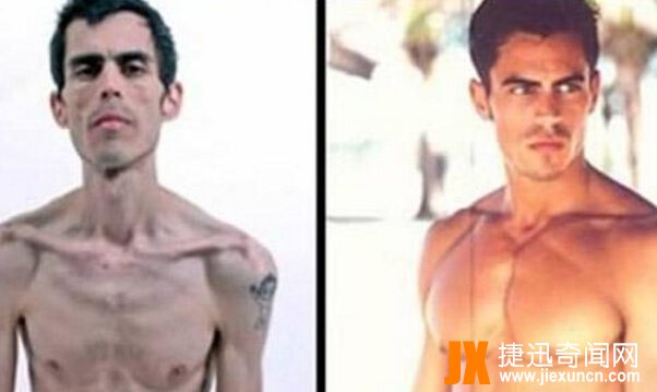 世界上最瘦的人