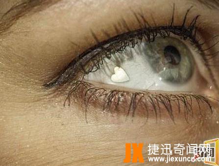 美国美女整容,竟切开眼球往里放金属装饰