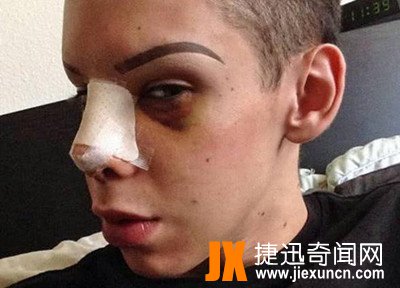 美国帅小伙迷恋外星人,疯狂整容110次却变杀马特?   www.jiexuncn.com