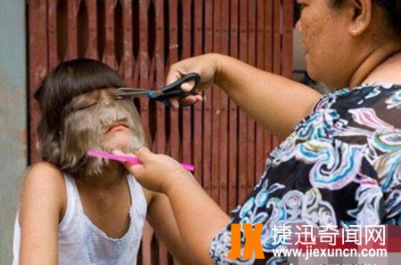 世界上毛发最多的人