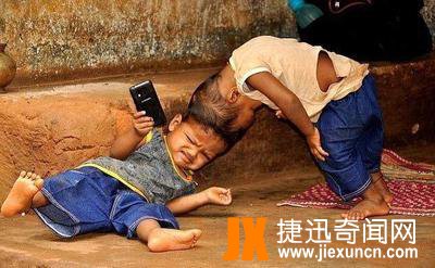 印度连体兄弟,共用一个头颅骨