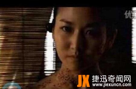 超级恶心芝麻女孩的故事,芝麻镶进毛孔用牙签挑(图片/慎点)