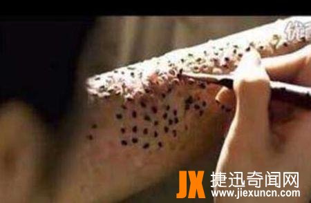 超级恶心芝麻女孩的故事,芝麻镶进毛孔用牙签挑(图片/慎点)