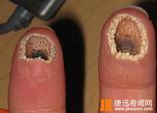 世界十大最恶心的图片：你能忍到第几张（图）