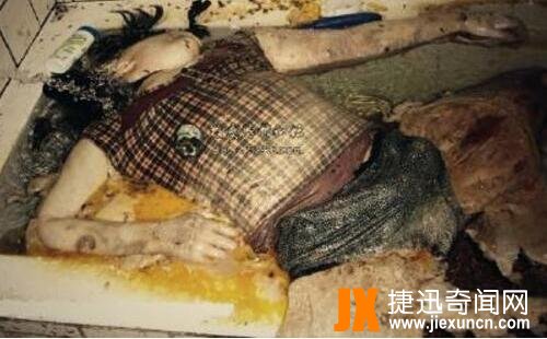 世界十大最恶心的图片：你能忍到第几张（图）