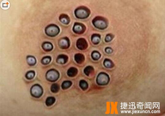 世界十大最恶心的图片：你能忍到第几张（图）