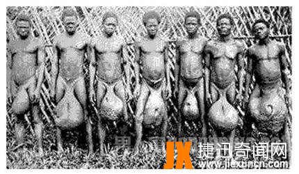 北非“巨蛋族”