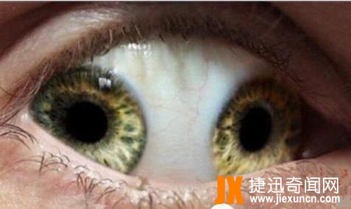 世界十大恐怖眼球，双瞳孔眼乃绝世罕见 胆小慎入