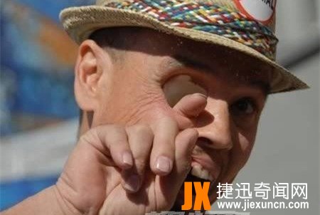 世界十大恐怖眼球，双瞳孔眼乃绝世罕见 胆小慎入
