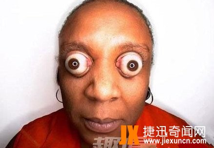 世界十大恐怖眼球，双瞳孔眼乃绝世罕见 胆小慎入