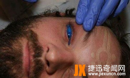 世界十大恐怖眼球，双瞳孔眼乃绝世罕见 胆小慎入