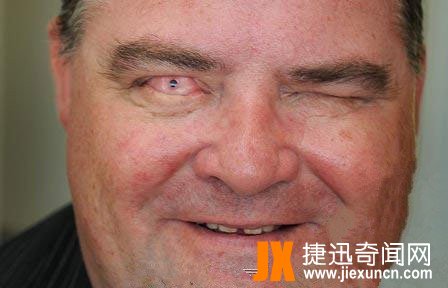 世界十大恐怖眼球，双瞳孔眼乃绝世罕见 胆小慎入
