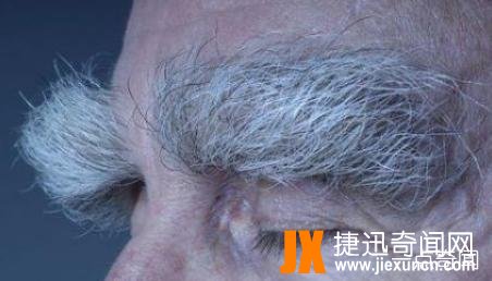 世界上最长的眉毛（19.1cm）是世界上最长的眉毛