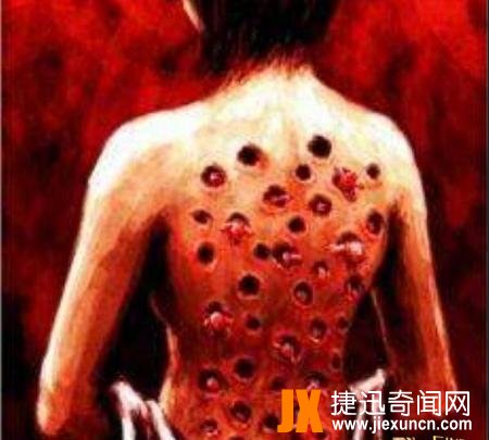 十宗罪玉米男孩真实事件，密集恐惧症人群慎入(图片)