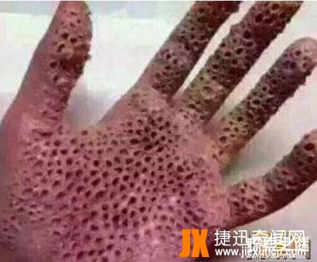 十宗罪玉米男孩真实事件，密集恐惧症人群慎入(图片)