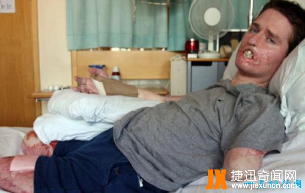 世界上最恶心的人 盘点世界上最丑最恶心的人