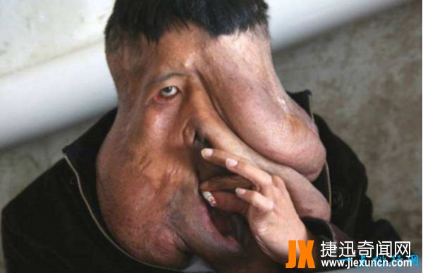世界上最恶心的人 盘点世界上最丑最恶心的人