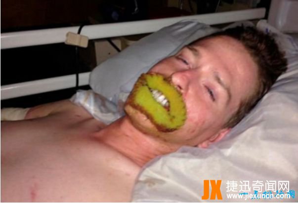 世界上最恶心的人 盘点世界上最丑最恶心的人