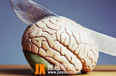 脑死亡
