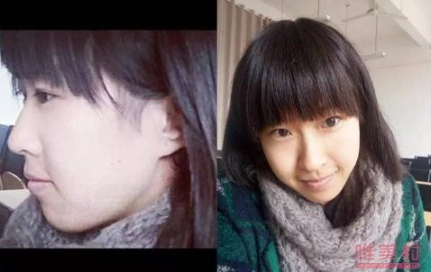 最强大脑陈小桥长发照