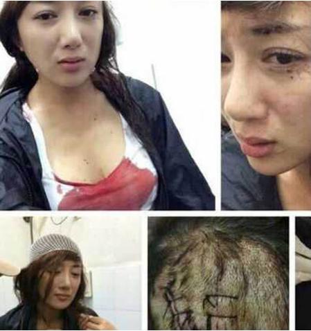 李依晓被咬事件