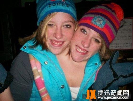 连体人