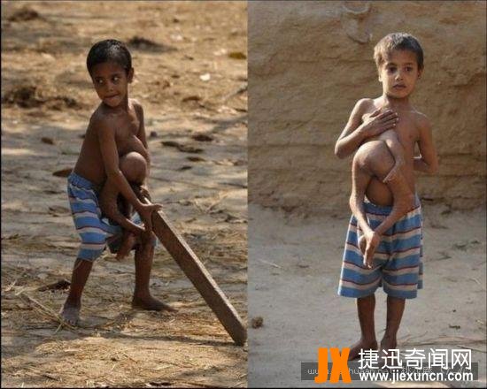 连体人