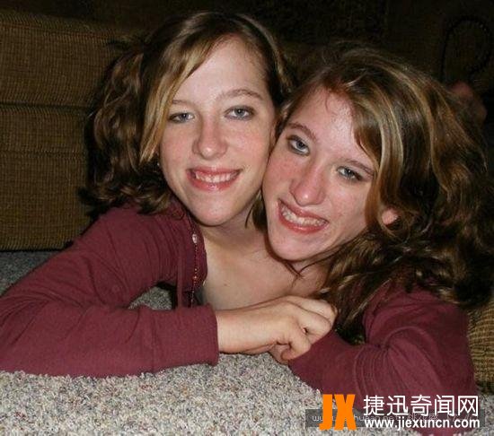 连体人
