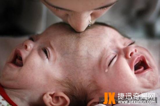 连体人