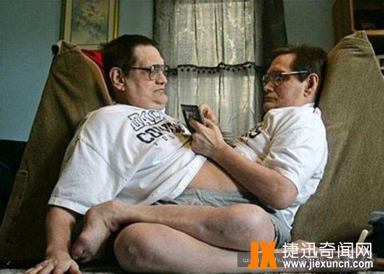 连体人