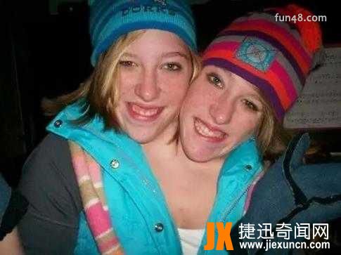 双头人连体人