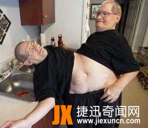 连体人：最长寿连体人