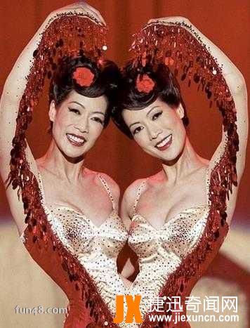 世界上最美的连体女人