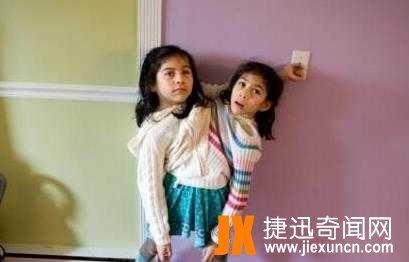 为什么会有连体人