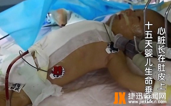 中国最小婴儿