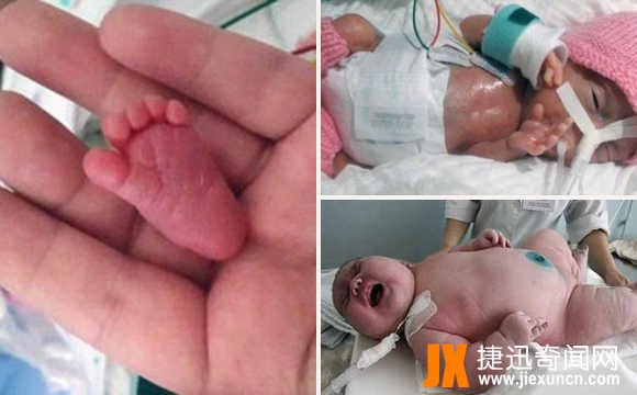 中国最小婴儿