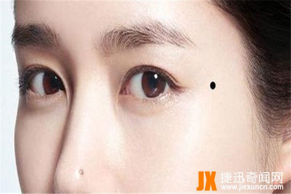 面部10处恶痣：痣在不同位置有不同意义