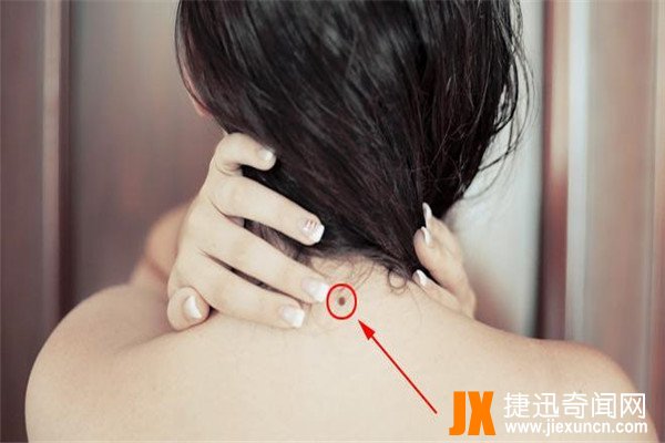面部10处恶痣：痣在不同位置有不同意义