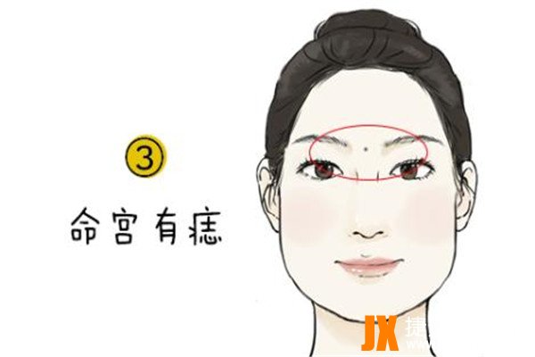 面部10处恶痣:痣在不同位置有不同意义