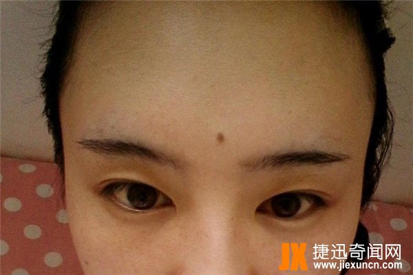 面部10处恶痣：痣在不同位置有不同意义