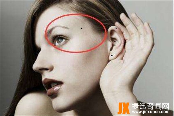 面部10处恶痣：痣在不同位置有不同意义