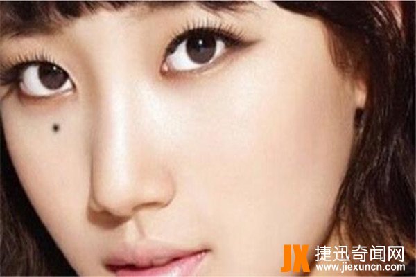 面部10处恶痣：痣在不同位置有不同意义
