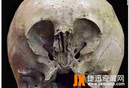 墨西哥怪异头骨之谜
