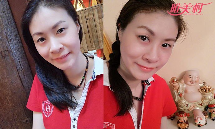 赵蕊蕊近照